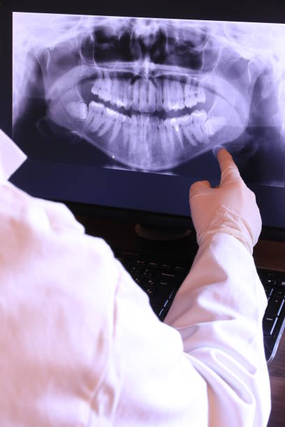 Best Emergency Treatment for Oral Infections in Walker, LA