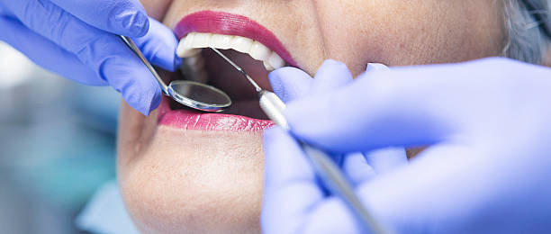 Best Knocked-Out Tooth (Avulsed Tooth) Treatment in Walker, LA